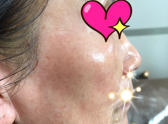 80歳でこのお肌！理想的ですね。